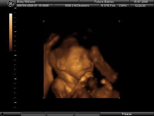 Speck's first smile