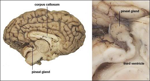 pinealgland.jpg