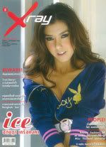 Cover_Xray_Ice_150w.jpg
