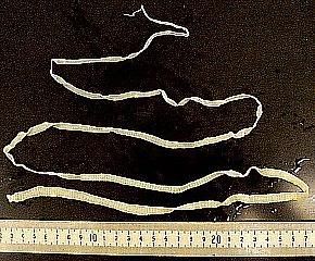 tapeworm.jpg