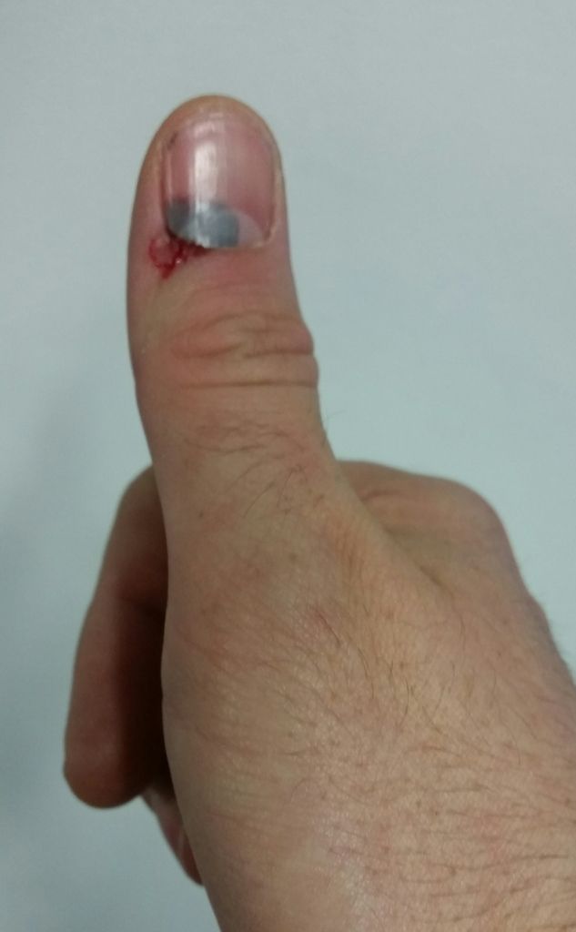 20150929_093425_zpsrgxm0ith_edit_1443527