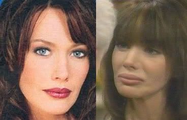 Hunter Tylo Plastic Surgery on Hunter Tylo Plastic Surgery Jpg