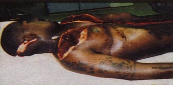 Tupac+autopsy+photos+real