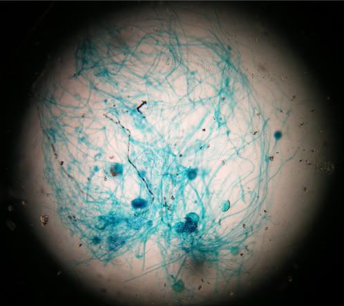 Methylene Blue Yeast